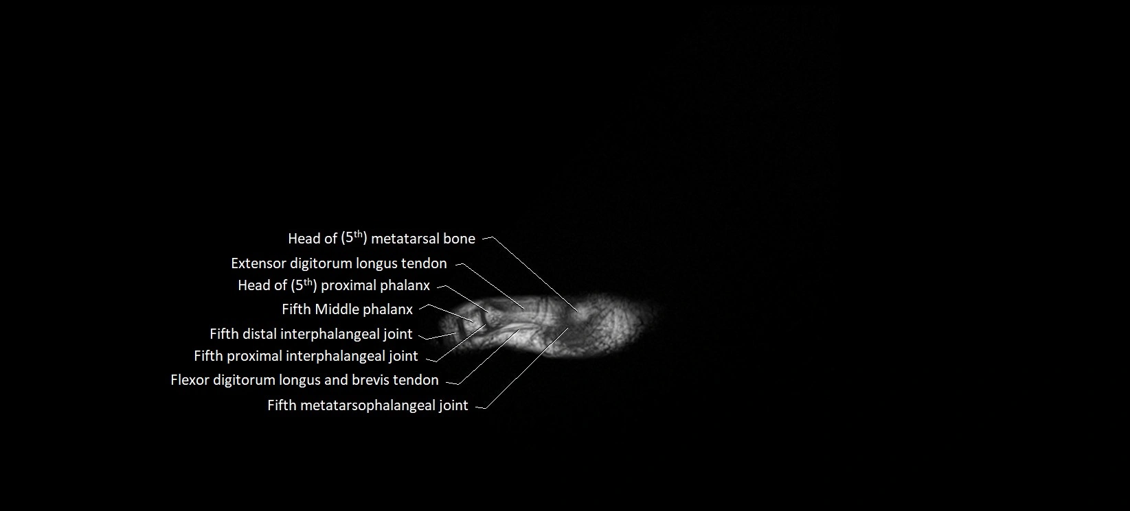 MRI foot sagittal labelled cross sectional anatomy image  26.webp